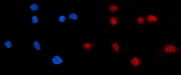 IF analysis of KPNB1 using anti-KPNB1 antibody (A01851-2)