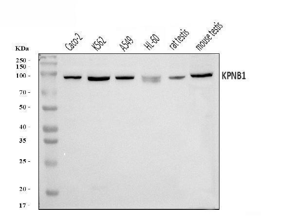  Western blot analysis of KPNB1 using anti-KPNB1 antibody (A01851-2)