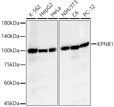 a01851 kpnb1 primary antiboties wb testing 1