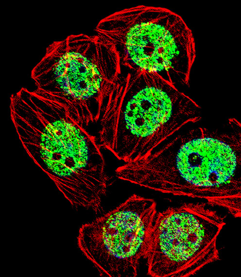 Fluorescent confocal image of A549 cell stained with FOXG1 Antibody (Center)