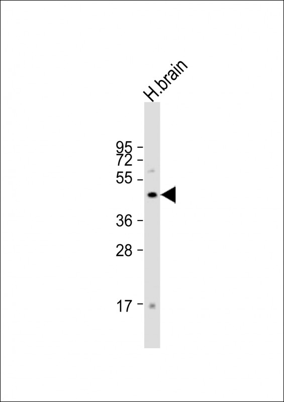Anti-FOXG1 Antibody (Center) at 1:1000 dilution + human brain lysateLysates/proteins at 20 µg per lane