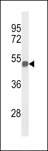Western blot analysis of FOXG1 Antibody (Center) (Cat