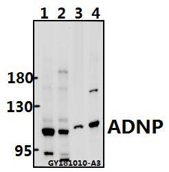 a01855 1 adnp primary antiboties wb testing 1