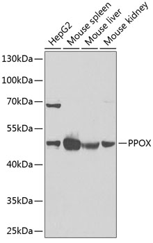 Western blot analysis of extracts of various cell lines, using PPOX Antibody  at 1:1000 dilution