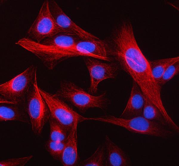 a01857 1 tubb primary antibodies if testing 4_1
