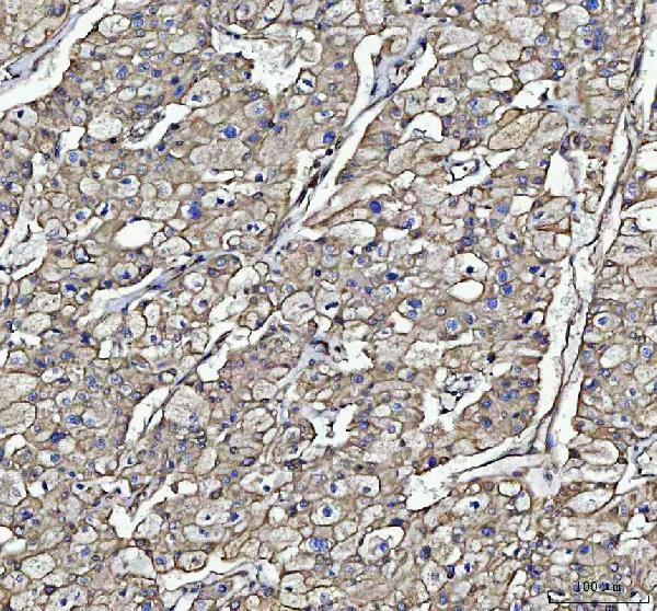 a01857 1 tubb primary antibodies ihc testing 2_1