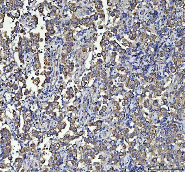 a01857 1 tubb primary antibodies ihc testing 3_1