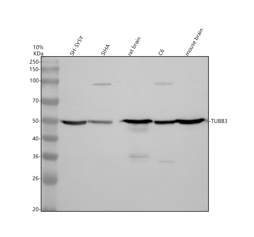 Western blot analysis of beta III Tubulin/TUBB3 using anti-beta III Tubulin/TUBB3 antibody (A01857-3)