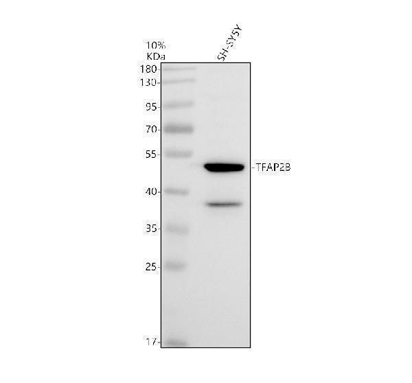 a01858 1 tfap2b primary antibodies wb testing 1