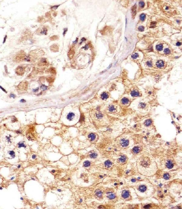 a01860 1 anti epha4 antibody center ihc p testing 2