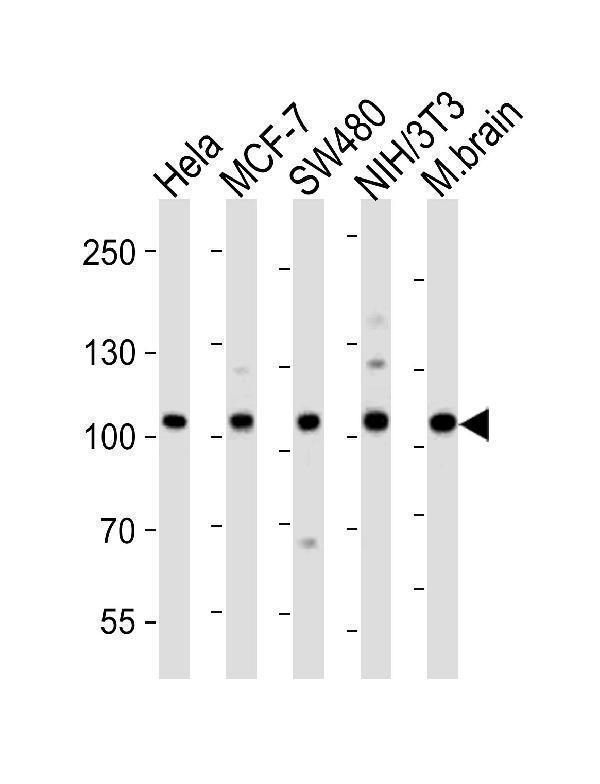 a01860 1 anti epha4 antibody center wb testing 1