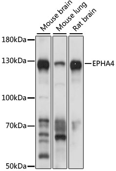 Western blot analysis of extracts of various cell lines, using EPHA4 antibody  at 1:1000 dilution