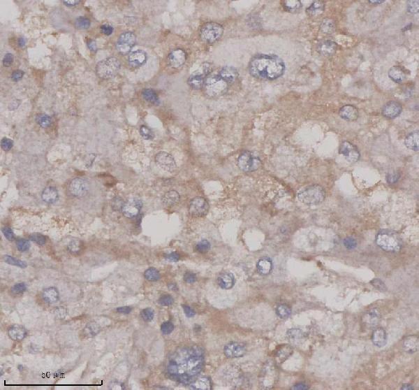 IHC analysis of SERPINE2 using anti-SERPINE2 antibody (A01863-1)