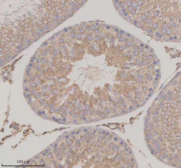 IHC analysis of SERPINE2 using anti-SERPINE2 antibody (A01863-1)