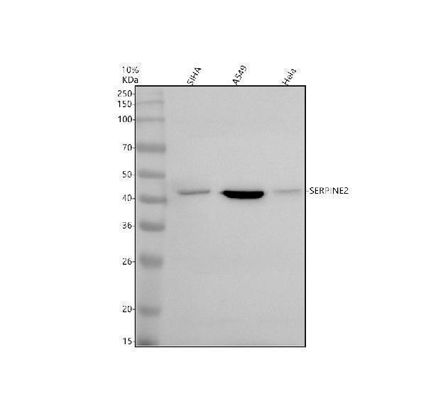 Western blot analysis of SERPINE2 using anti-SERPINE2 antibody (A01863-1)