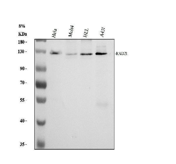 Western blot analysis of RAD21 using anti-RAD21 antibody (A01864-2)