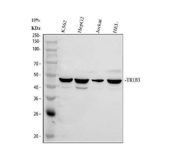 Western blot analysis of TRIB3 using anti-TRIB3 antibody (A01865-1)