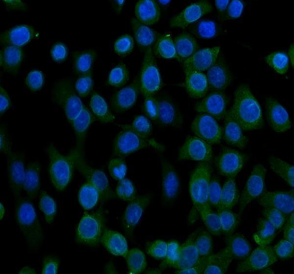 a01865 1 ugt1a1 primary antibodies if testing 1