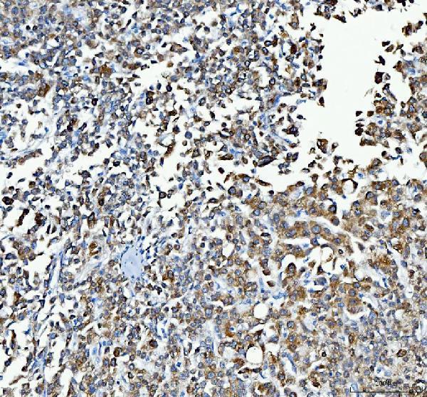 a01865 1 ugt1a1 primary antibodies ihc testing 1