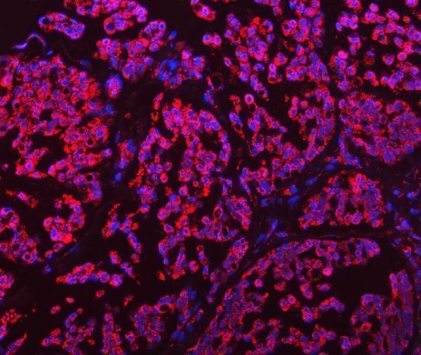a01866 2 glud1 2 primary antibodies if testing 15