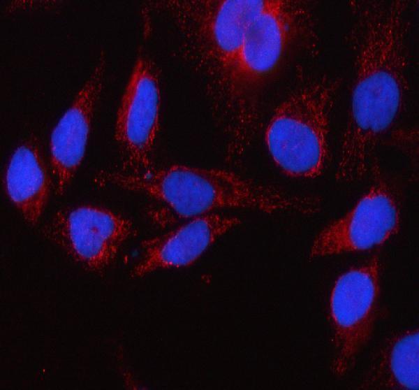 a01866 3 glud1 primary antibodies if testing 11