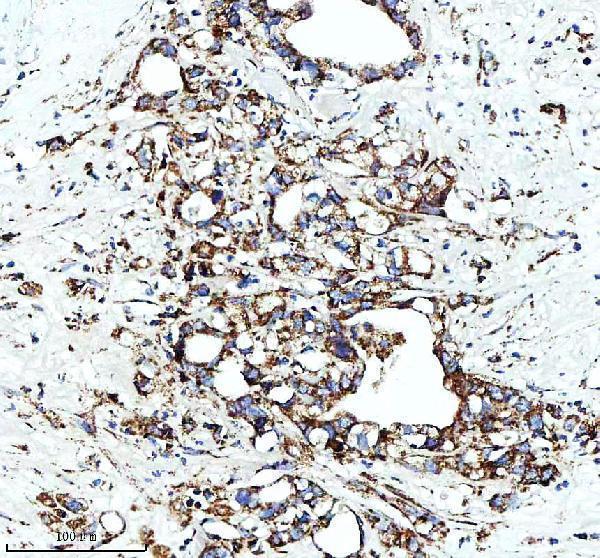 a01866 3 glud1 primary antibodies ihc testing 10
