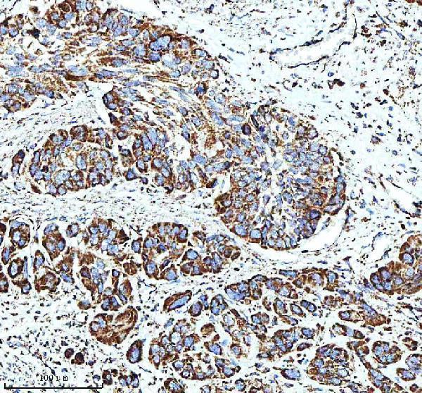  IHC analysis of GLUD1 using anti-GLUD1 antibody (A01866-3)