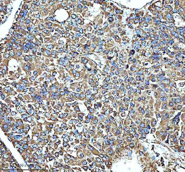a01866 3 glud1 primary antibodies ihc testing 4