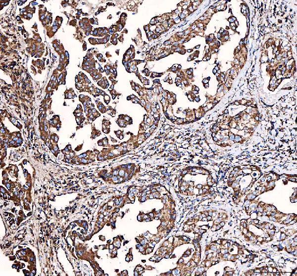a01866 3 glud1 primary antibodies ihc testing 5