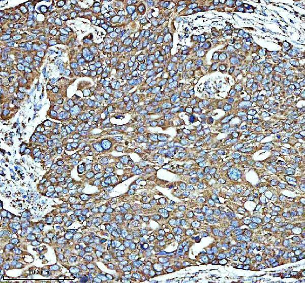 a01866 3 glud1 primary antibodies ihc testing 7