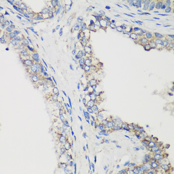 a01866 glud1 primary antiboties ihc testing 2