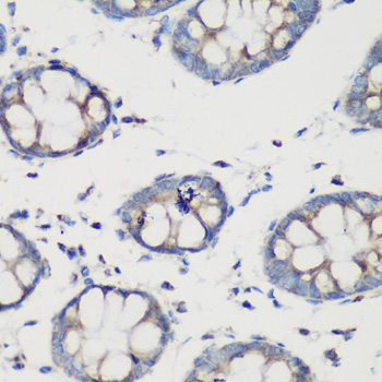 a01866 glud1 primary antiboties ihc testing 3