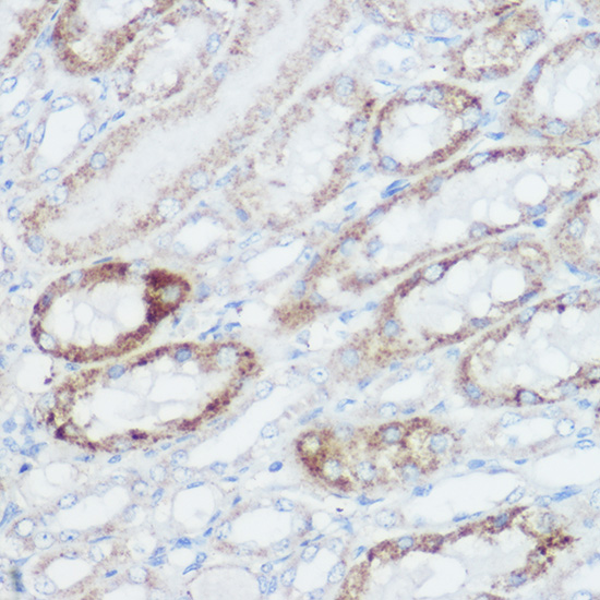 a01866 glud1 primary antiboties ihc testing 4