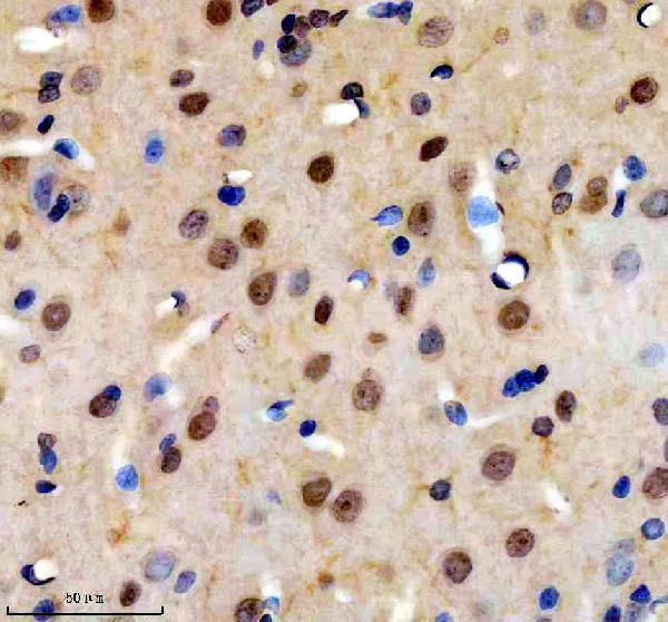 IHC analysis of TOPBP1 using anti-TOPBP1 antibody (A01867-1)