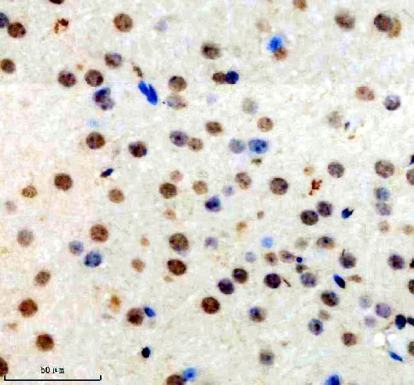 IHC analysis of TOPBP1 using anti-TOPBP1 antibody (A01867-1)