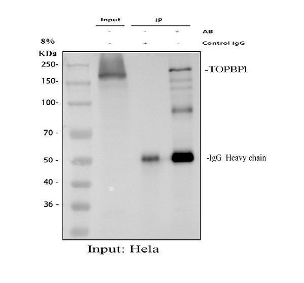 a01867 1 topbp1 primary antibodies ip testing 1