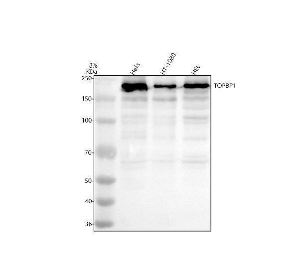 Western blot analysis of TOPBP1 using anti-TOPBP1 antibody (A01867-1)