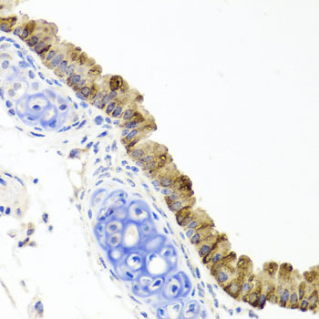 a01867 topbp1 primary antiboties ihc testing 2