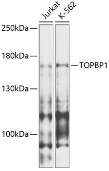 a01867 topbp1 primary antiboties wb testing 1
