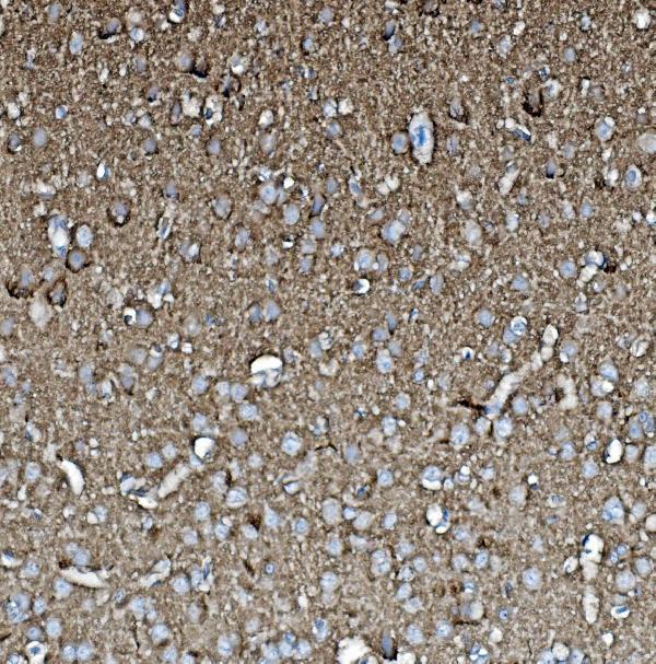 a01868 1 gap43 primary antibodies ihc testing 2