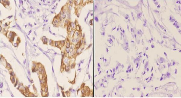 a01868s41 gap43 primary antiboties ihc testing 2