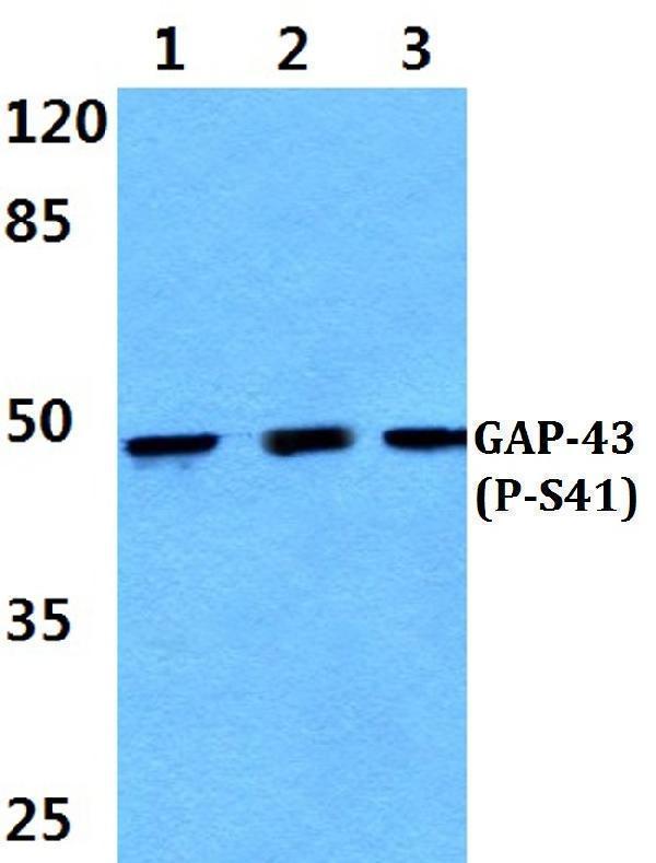 a01868s41 gap43 primary antiboties wb testing 1