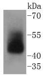 Western blot analysis of ADIPOR1 on human skeletal muscle lysates using anti-ADIPOR1 antibody at 1/1,000 dilution