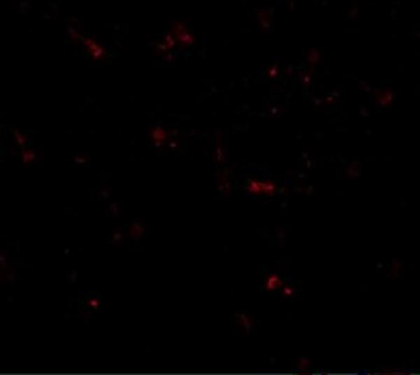 a01871 1 tmem173 primary antibodies if testing 6