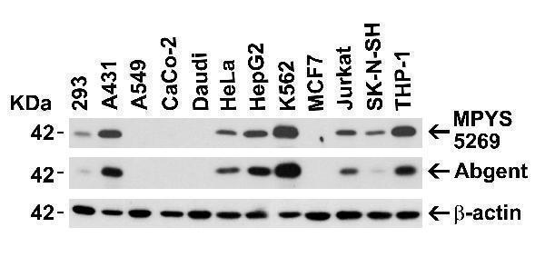 Independent Antibody Validation (IAV) via Protein Expression Profile in Human Cell Lines
Loading: 15 μg of lysates per lane