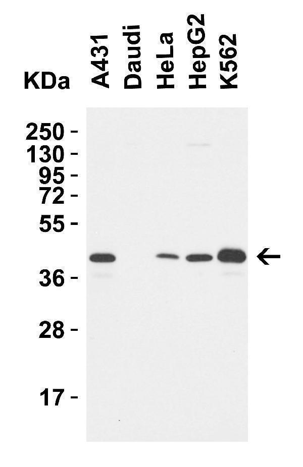 Western Blot Validation in Human Cell Lines
Loading: 15 μg of lysates per lane