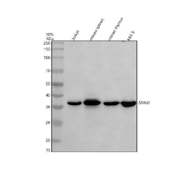 Western blot analysis of TMEM173/STING using anti-TMEM173/STING antibody (A01871-3)
