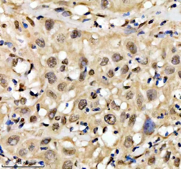 a01874 3 qki primary antibodies ihc testing 2
