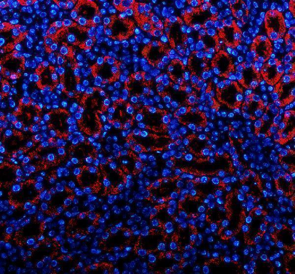 a01875 2 pdgfd primary antibodies if testing 1