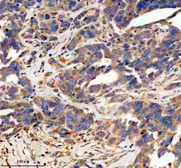 IHC analysis of PDGFD using anti-PDGFD antibody (A01875-2)
